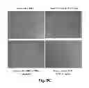 Fig. 08 - Use of Stem Cells to Reduce Leukocyte Extravasation