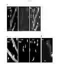 Fig. 04 - Composition comprising expression or activity inhibitors of Ninjurin1 for the prevention and treatment of inflammatory disease