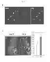 Fig. 06 - Composition comprising expression or activity inhibitors of Ninjurin1 for the prevention and treatment of inflammatory disease