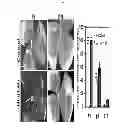 Fig. 07 - Composition comprising expression or activity inhibitors of Ninjurin1 for the prevention and treatment of inflammatory disease