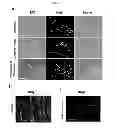 Fig. 22 - Composition comprising expression or activity inhibitors of Ninjurin1 for the prevention and treatment of inflammatory disease