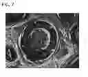 Fig. 08 - Scaffold for tissue regeneration in mammals