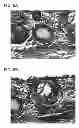 Fig. 09 - Scaffold for tissue regeneration in mammals