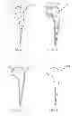 Fig. 06 - Methods for manufacturing titanium aluminide components from articles formed by consolidation processes