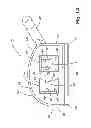 Fig. 02 - Reduced-friction buccal tube and method of use