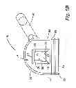 Fig. 03 - Reduced-friction buccal tube and method of use