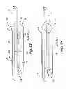 Fig. 08 - Reduced-friction buccal tube and method of use