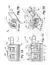 Fig. 10 - Reduced-friction buccal tube and method of use