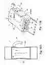 Fig. 13 - Reduced-friction buccal tube and method of use