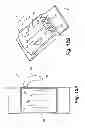 Fig. 15 - Reduced-friction buccal tube and method of use