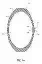 Fig. 02 - SPORT TRAINING DEVICE