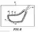 Fig. 08 - Method for manufacturing and golf club head