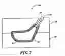 Fig. 09 - Method for manufacturing and golf club head
