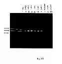 Fig. 09 - NOVEL BIOMARKERS FOR DETECTING NEURONAL LOSS