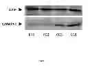 Fig. 02 - Method of treating metastatic cancer