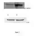 Fig. 04 - Method of treating metastatic cancer