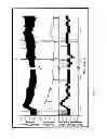 Fig. 06 - Treatment of glaucoma