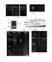 Fig. 02 - Pharmaceutical composition for treating aging-associated diseases, containing progerin expression inhibitor as active ingredient, and screening method of said progerin expression inhibitor