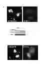 Fig. 09 - Pharmaceutical composition for treating aging-associated diseases, containing progerin expression inhibitor as active ingredient, and screening method of said progerin expression inhibitor