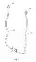 Fig. 02 - Device, system and methods for introducing soft tissue anchors