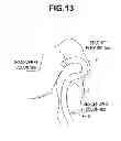 Fig. 09 - ENDOSCOPE SYSTEM