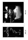 Fig. 07 - OPTICAL COHERENCE TOMOGRAPHY SYSTEM AND METHOD FOR REAL-TIME SURGICAL GUIDANCE