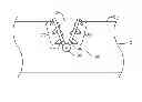 Fig. 01 - Hinged tissue support device