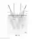 Fig. 03 - Optoacoustic imaging system having handheld probe utilizing optically reflective material