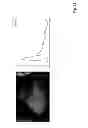 Fig. 32 - ULTRASONIC SYSTEM FOR ASSESSING TISSUE SUBSTANCE EXTRACTION