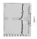 Fig. 09 - Detecting or validating a detection of a state change from a template of heart rate derivative shape or heart beat wave complex