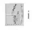 Fig. 17 - Detecting or validating a detection of a state change from a template of heart rate derivative shape or heart beat wave complex