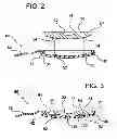 Fig. 03 - Tampon assembly
