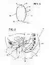 Fig. 04 - Tampon assembly