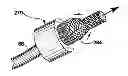 Fig. 01 - Graft apparatus