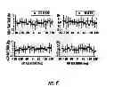 Fig. 06 - Impact monitoring system for players engaged in a sporting activity