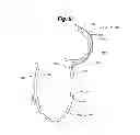 Fig. 12 - Orthopedic brace for animals