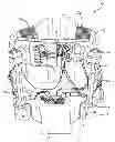 Fig. 01 - Active exoskeletal spinal orthosis and method of orthotic treatment