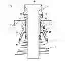 Fig. 01 - Systems for implanting and using a conduit within a tissue wall