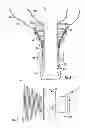 Fig. 03 - Systems for implanting and using a conduit within a tissue wall