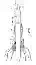 Fig. 07 - Systems for implanting and using a conduit within a tissue wall