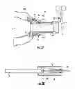 Fig. 08 - Systems for implanting and using a conduit within a tissue wall