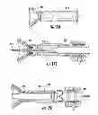 Fig. 15 - Systems for implanting and using a conduit within a tissue wall