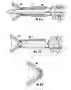 Fig. 16 - Systems for implanting and using a conduit within a tissue wall