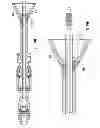 Fig. 20 - Systems for implanting and using a conduit within a tissue wall