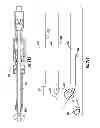 Fig. 24 - Systems for implanting and using a conduit within a tissue wall
