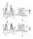 Fig. 29 - Systems for implanting and using a conduit within a tissue wall