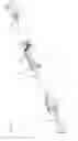 Fig. 02 - INJECTION DEVICE FOR AESTHETIC MEDICINE