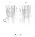 Fig. 03 - Device for Injecting Adjustable Doses of Liquid Drug