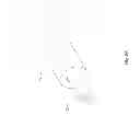 Fig. 43 - Method for clearing blockages in in-situ artificial lumens