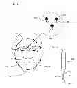 Fig. 02 - Devices and methods for wearable injection guides